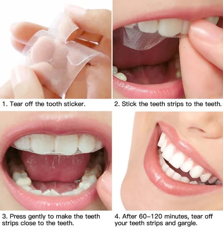 Smile Kit Pro HP Formula Flavoured Teeth Whitening Strips Sakura Vanilla