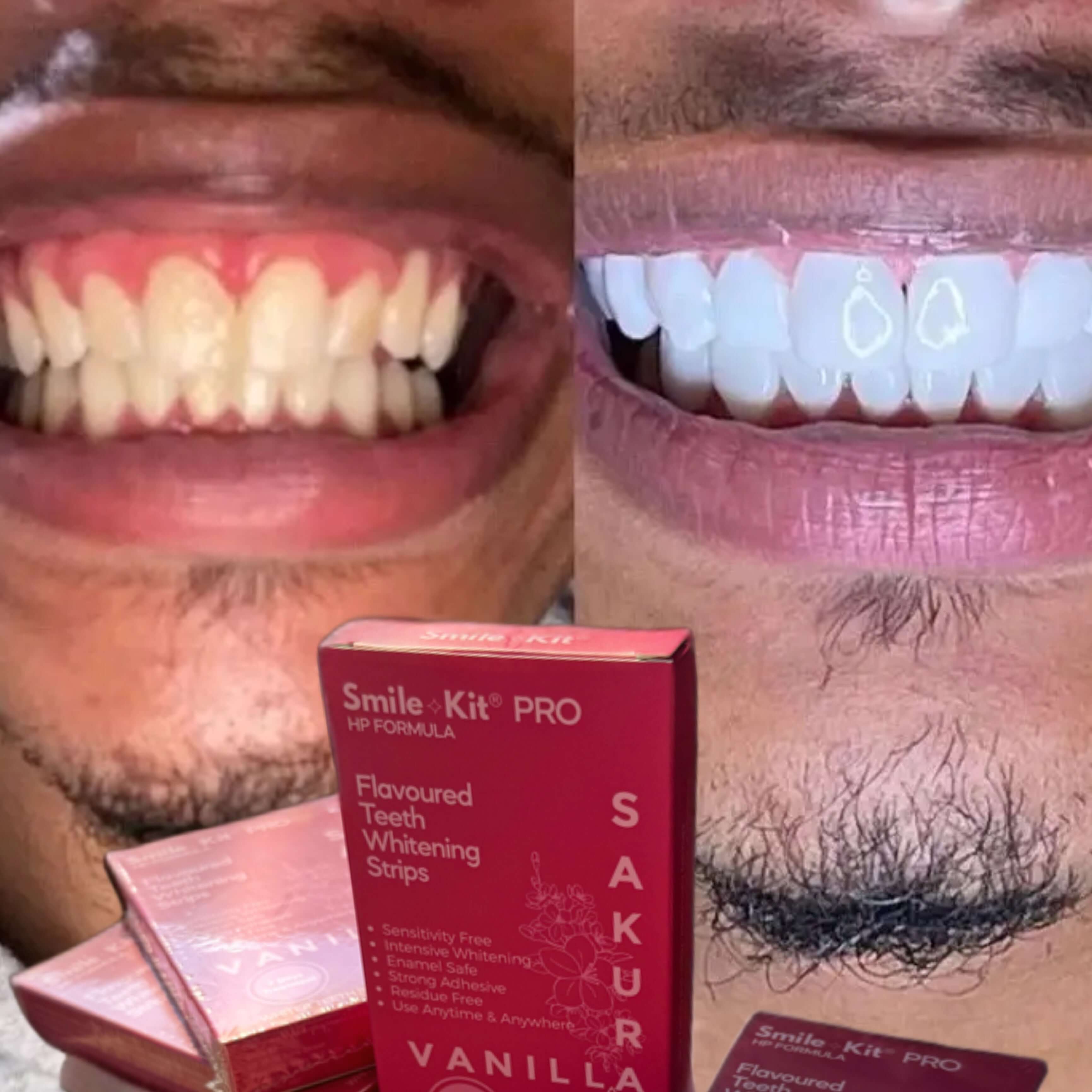 Smile Kit Pro HP Formula Flavoured Teeth Whitening Strips Sakura Vanilla