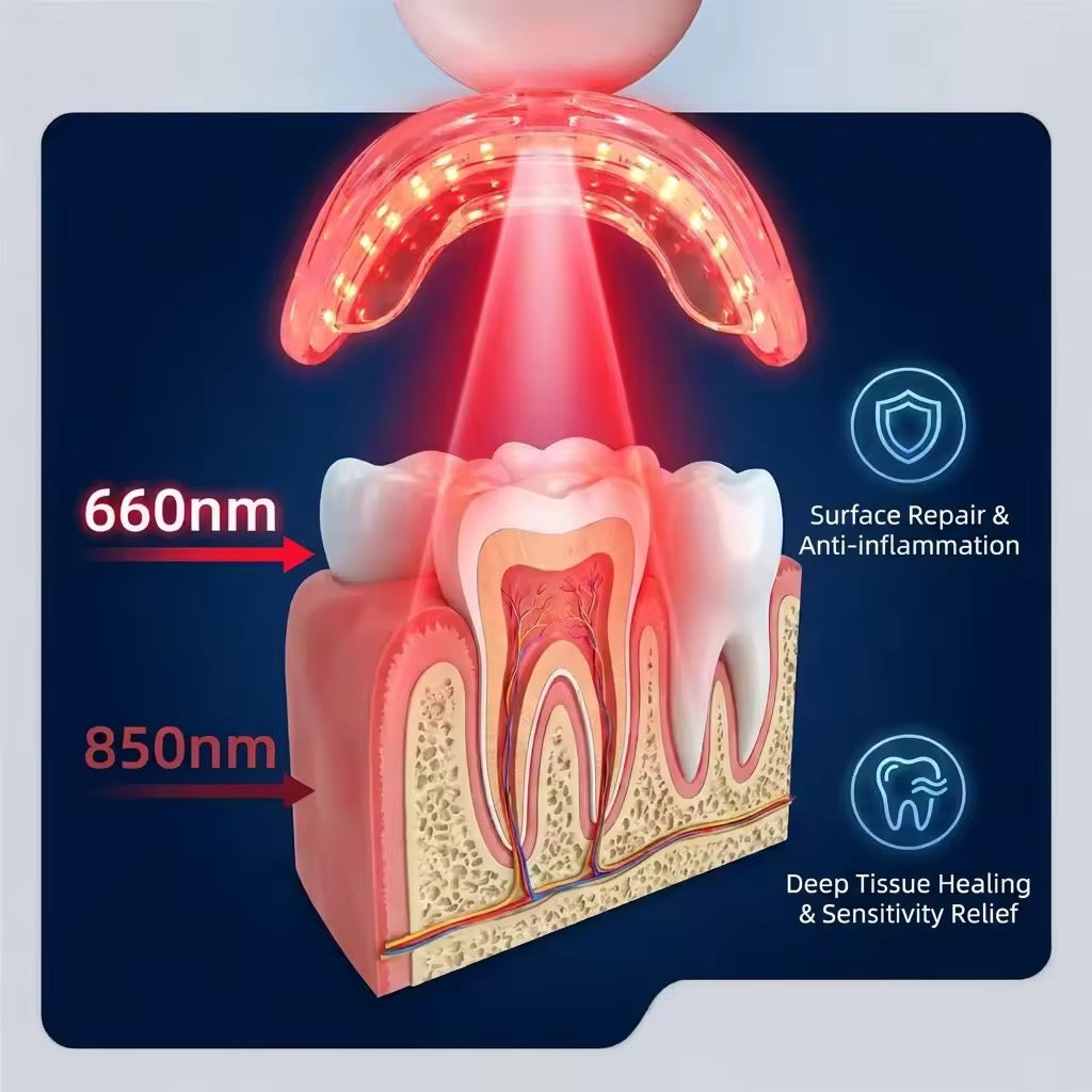 Oral Red Light Therapy Device – 660nm Red + 850nm Near-Infrared Dual-Wavelength Oral Care