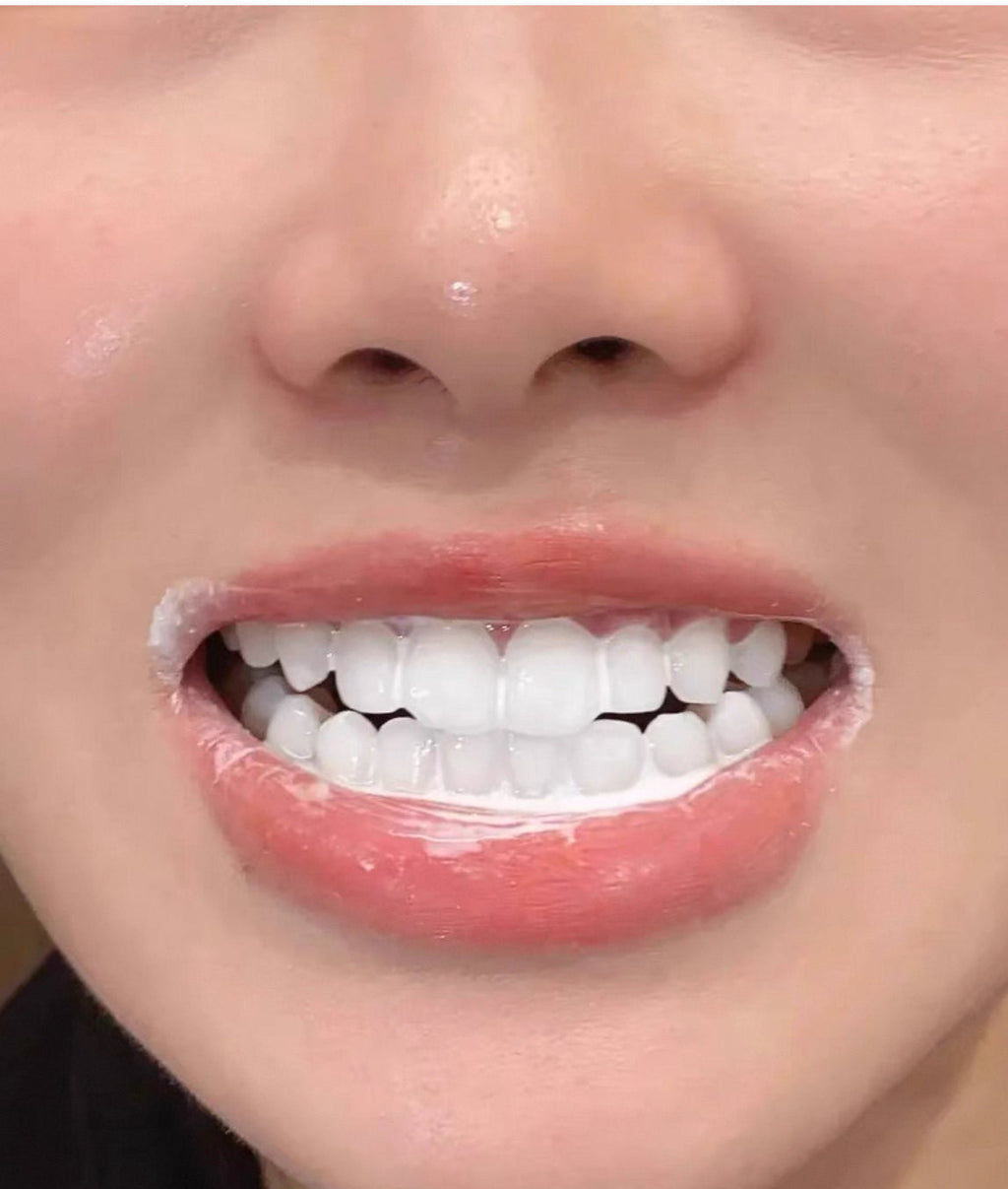 Instant Teeth Whitening Patches with White Moonlight Dental Membrane Gel