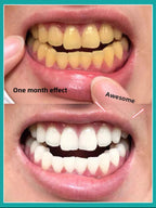 Instant Teeth Whitening Patches with White Moonlight Dental Membrane Gel