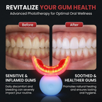Oral Red Light Therapy Device – 660nm Red + 850nm Near-Infrared Dual-Wavelength Oral Care