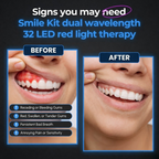 Oral Red Light Therapy Device – 660nm Red + 850nm Near-Infrared Dual-Wavelength Oral Care