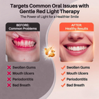 Oral Red Light Therapy Device – 660nm Red + 850nm Near-Infrared Dual-Wavelength Oral Care